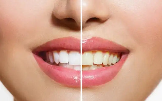 How To Remove Stains From Teeth Instantly? How To Get Rid Of Stain?